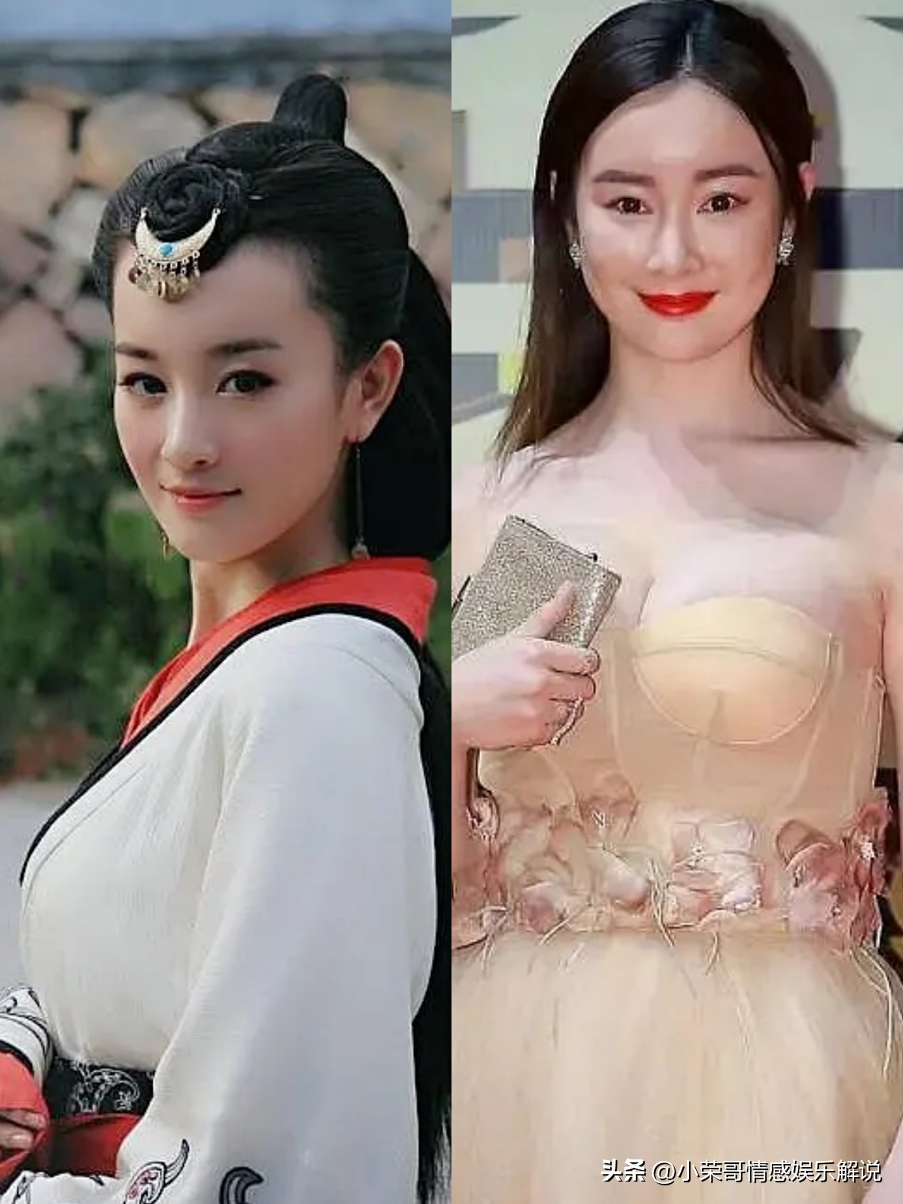 整容失败最惨的案例女明星,整容失败的女明星为啥不再整回来