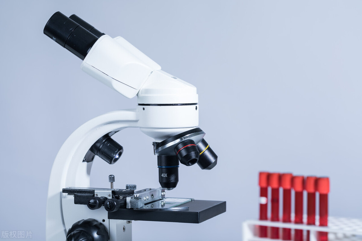 72岁老人血尿肾癌,93岁老人膀胱癌已经尿血