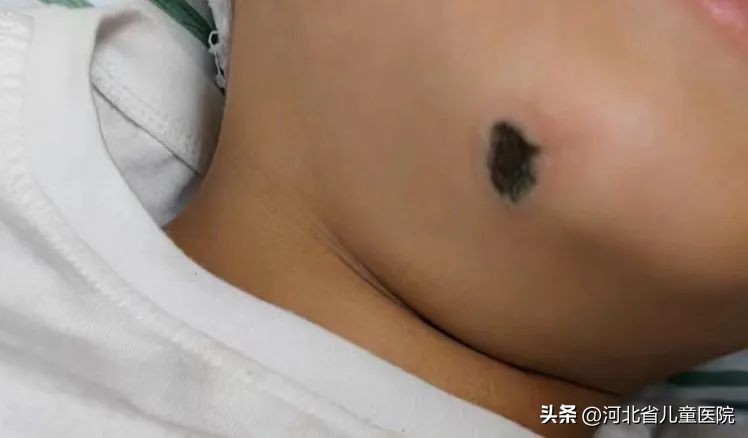 河北小孩救人后续,抢救电击小孩