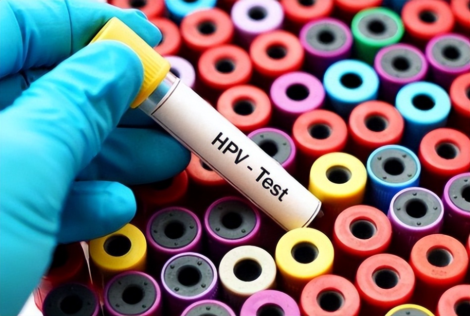 女性查hpv做哪些检查,男性hpv检查二甲医院可以查吗