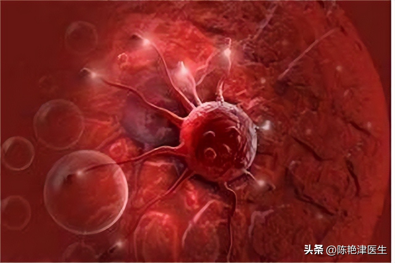 女性为什么容易长子宫肌瘤？提醒：平时尽量避免3个行为，别忽视