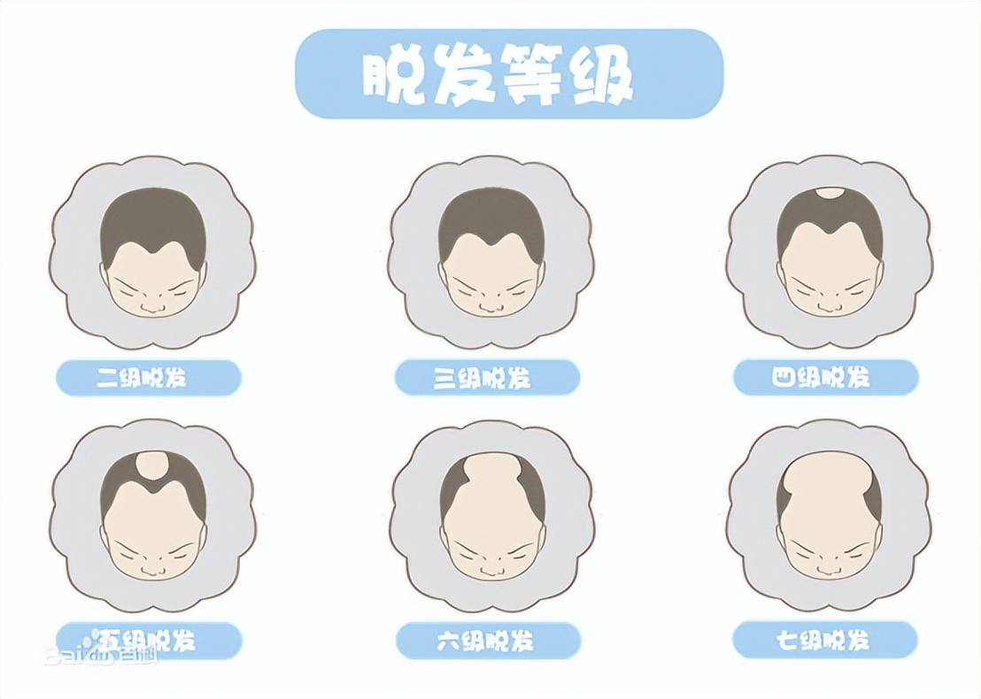 生发头盔生发仪真的有效果吗,激光生发仪是智商税吗