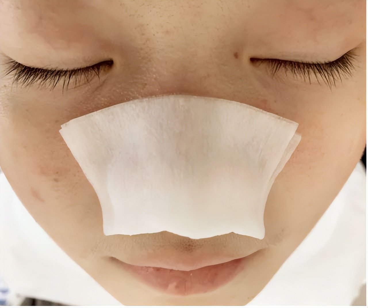 真黑头假黑头傻傻分不清楚，怎么去黑头？