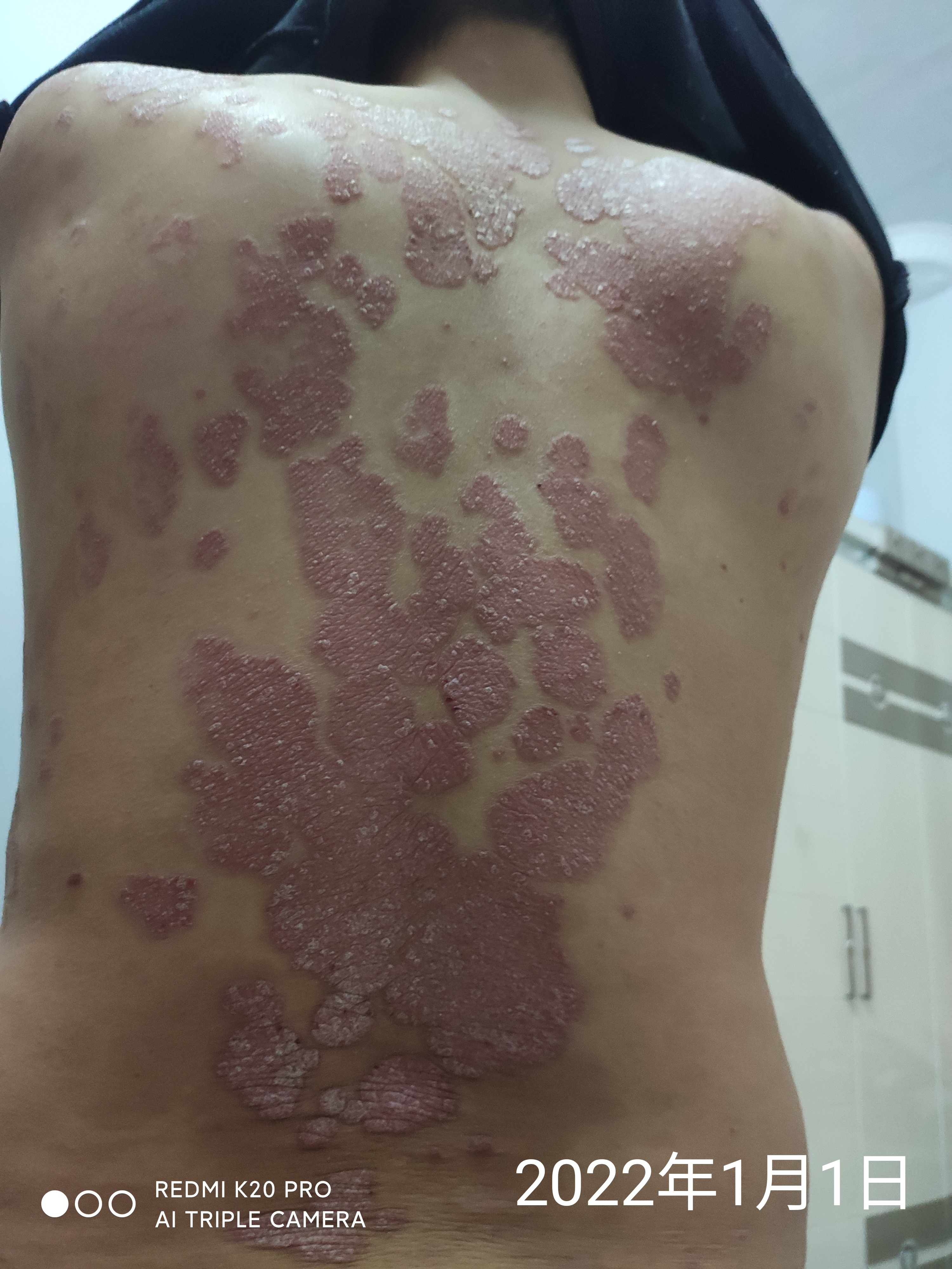 小牛-中牛-老牛-疯牛，牛皮癖患者悲怆的四步曲,随笔1