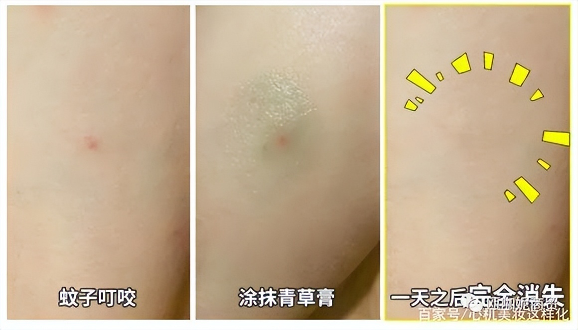 卡瓦库德薄荷膏跟青草膏有区别吗,泰国原装进口卡瓦库德薄荷膏