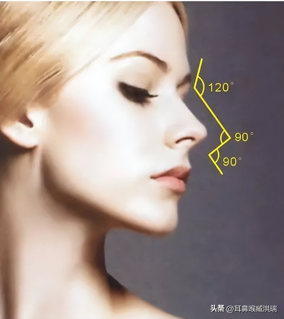 捏鼻子让鼻子变大了该怎么恢复,捏了一年鼻头的变化