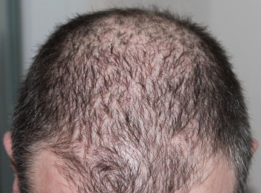 中医治疗小孩夜惊症,小儿发惊的原因如何治疗