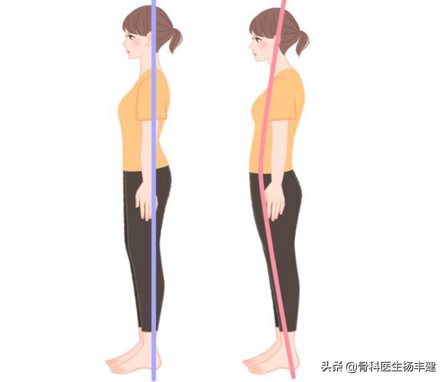 身高1.86米当骨科医生好不好,骨科长高建议