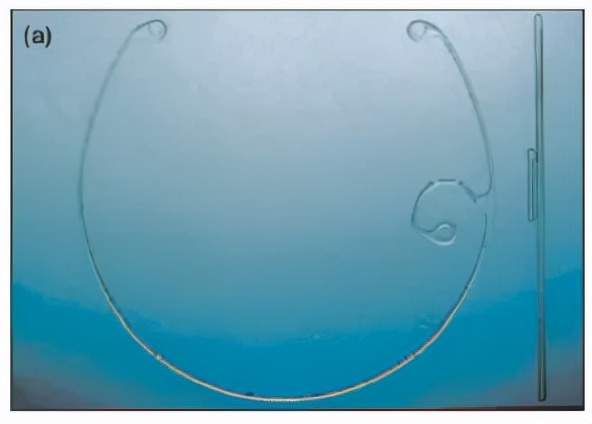 囊袋张力环植入过程,囊袋张力环优缺点