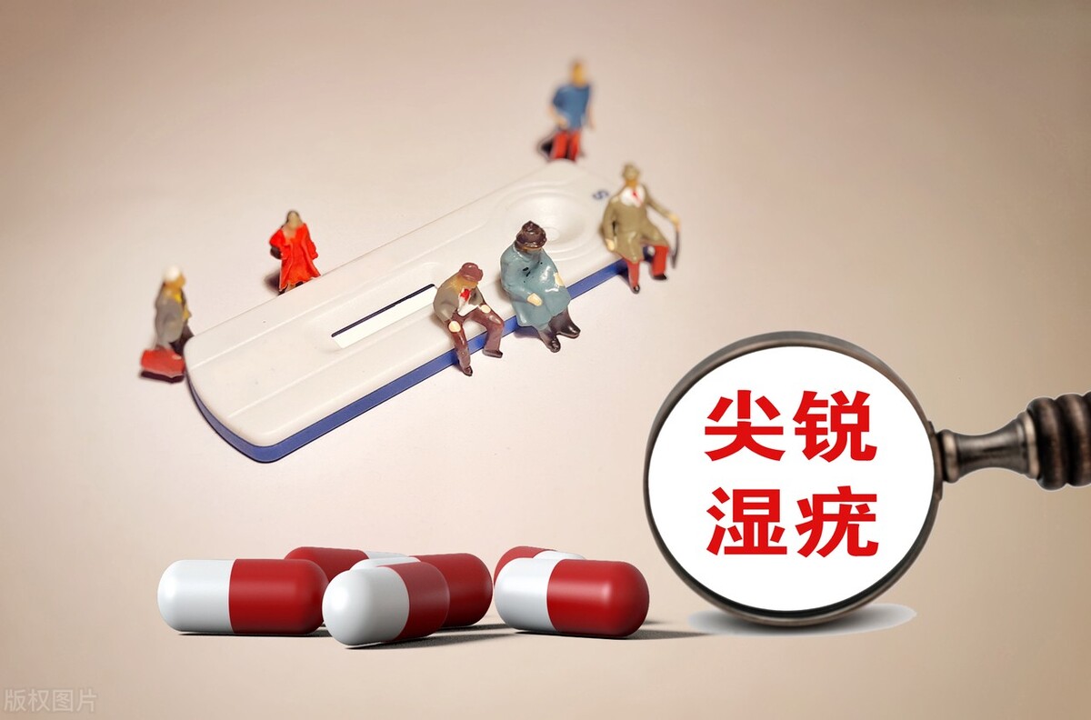 什么是尖锐性湿疣症状,尖锐湿疣