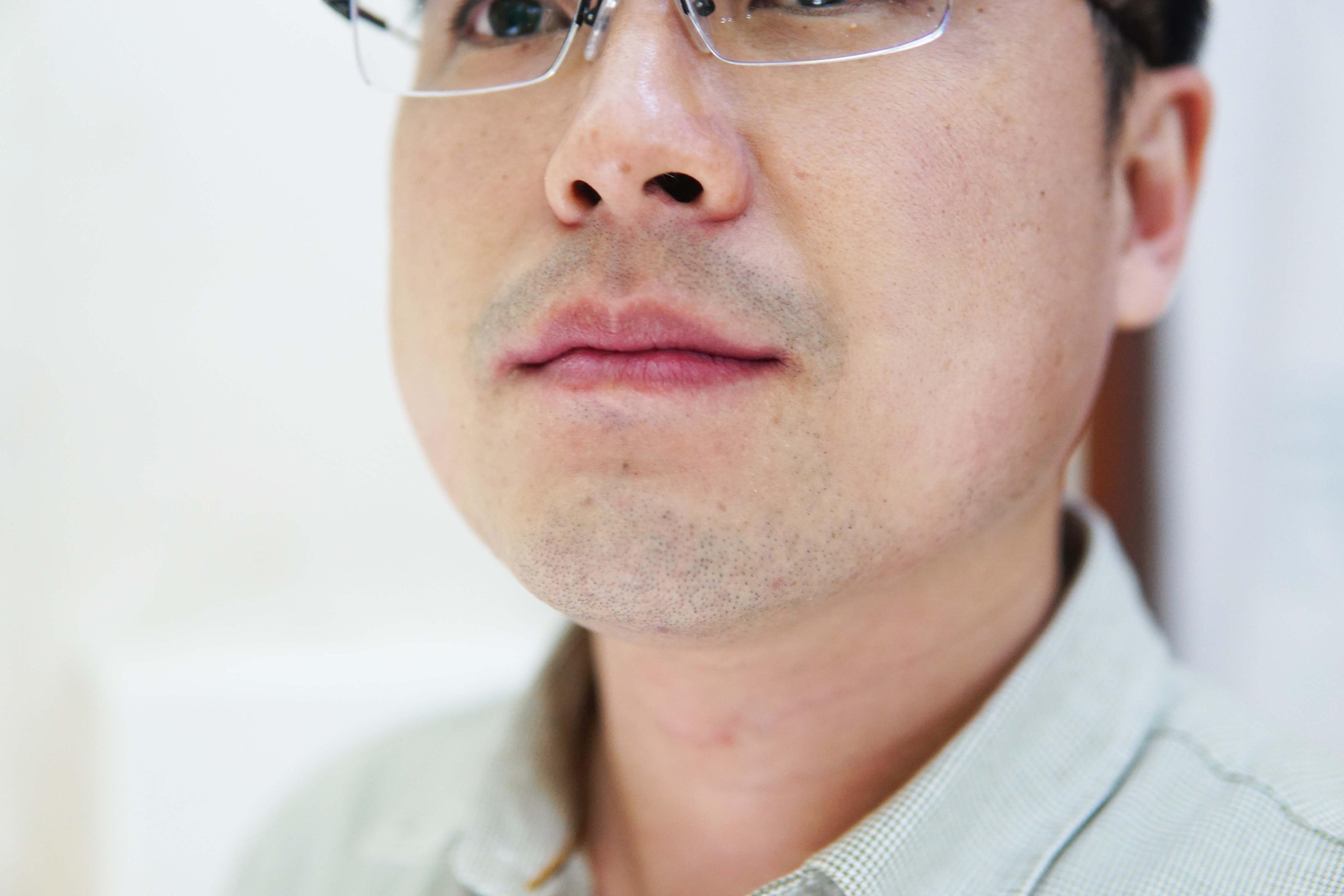 鐒曢啋鏄熸礊灏忛纰熷墐椤诲垁璇勬祴,鐒曢啋鏄熸礊灏忛纰熷墐椤诲垁