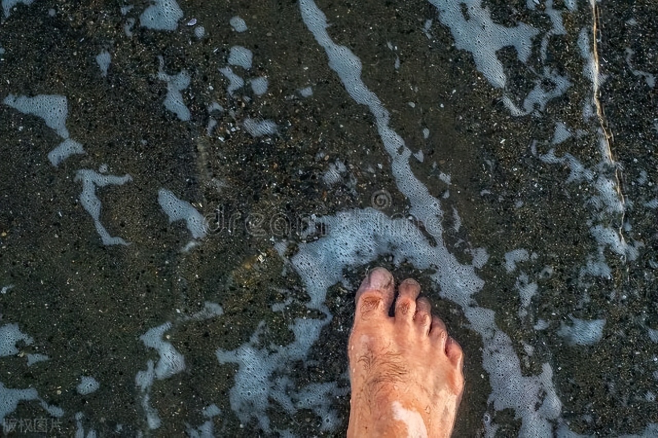 神经性白癜风的症状,初期白癜风白斑症状