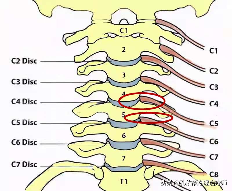 神经根颈椎病的症状和治疗方法,椎动脉颈椎病的症状和治疗方法