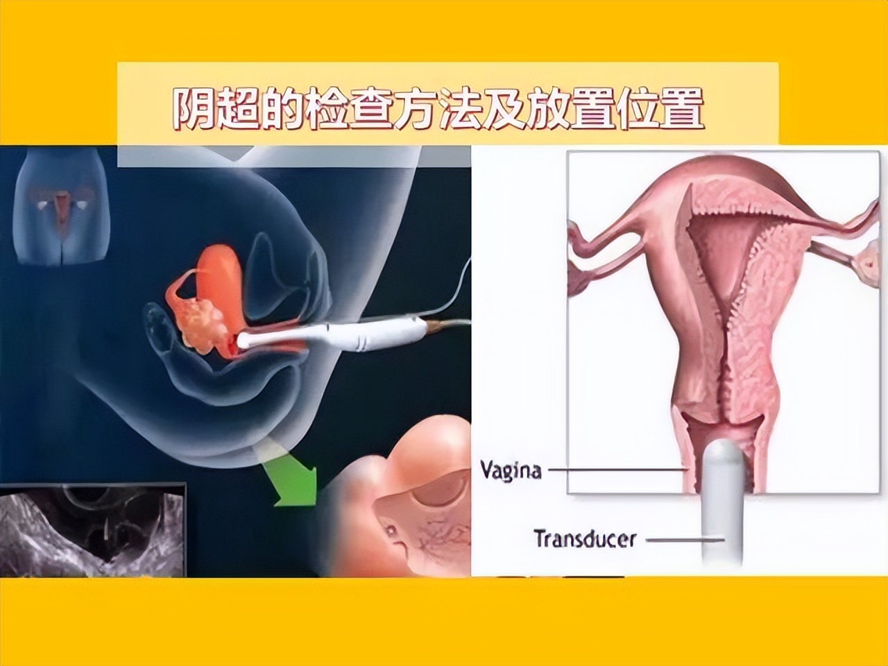 阴超可怕吗,阴超有多可怕啊