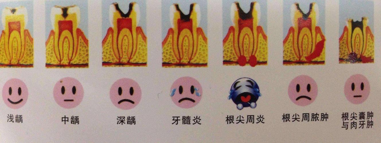 过年牙疼怎么办一招教你3秒止痛,特殊时期牙疼如何自救