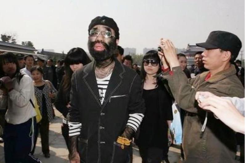 当年轰动一时的“毛孩”：42岁娶90后娇妻，生下一子未遗传长毛