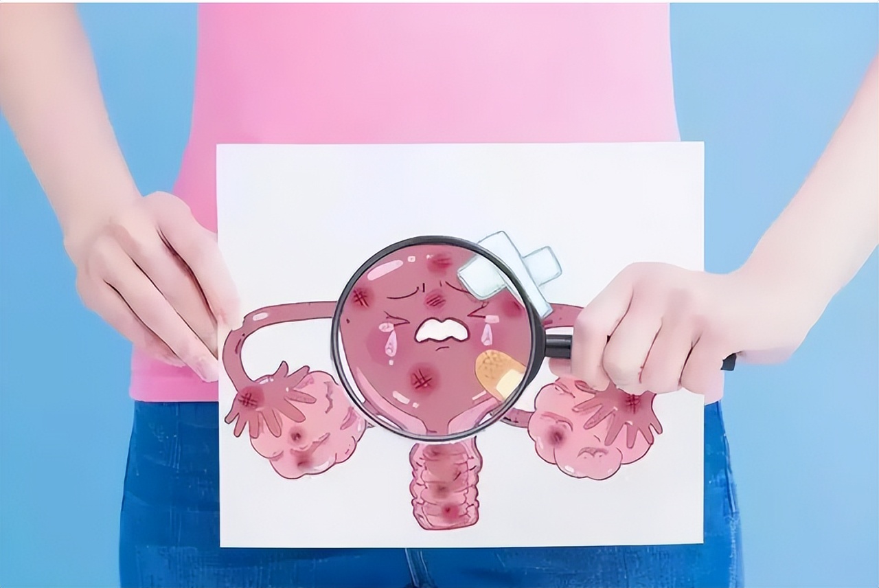 宫颈癌是“拖”出来的？病情若进展到中晚期，女人或出现3个异常