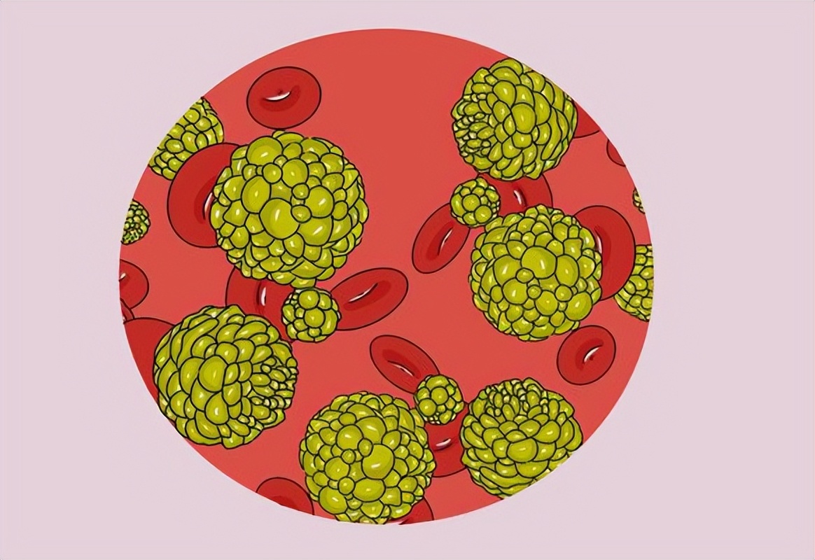 消肿散结治结节的配方,结节散结处方