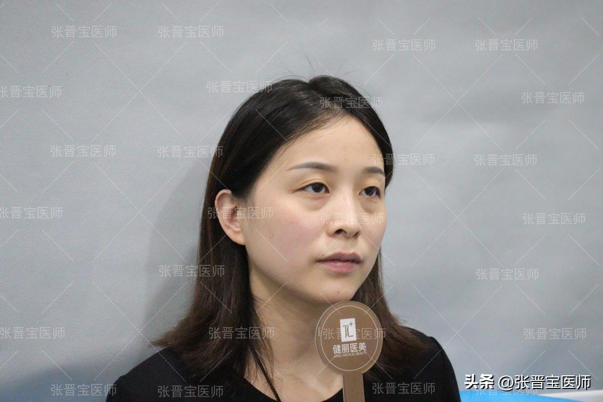 去眼袋手术后期变老,去眼袋手术的真实感受