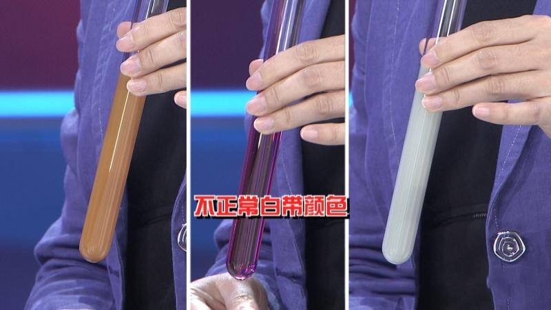 裤上有黄渍怎么办,裤头上面很黄是有炎症吗