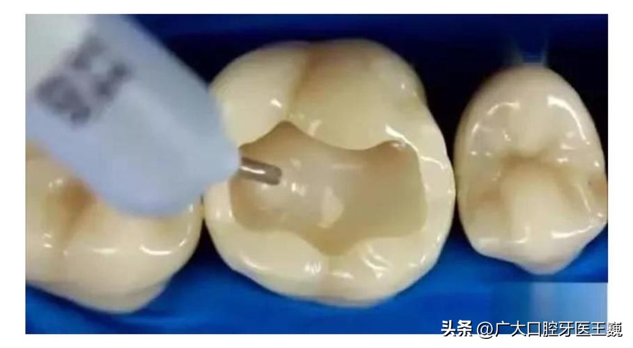 口腔科普缺牙而已真的这么可怕吗,口腔科普讲解牙齿缺失