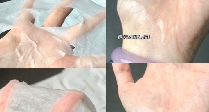 婴儿肌护肤品,婴儿肌孕妇护肤品