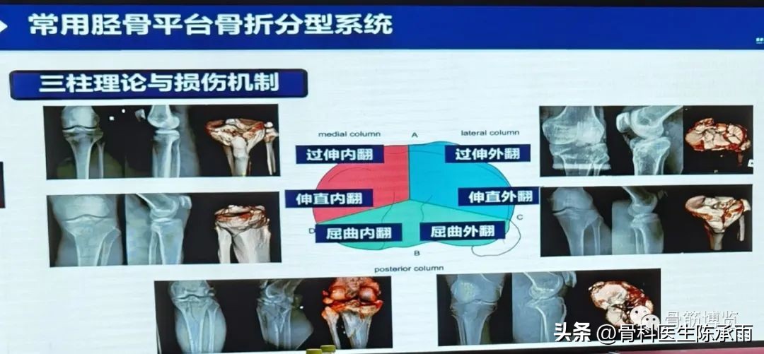 国家卫健委主办的骨创伤专项能力培训项目----下肢损伤学习班