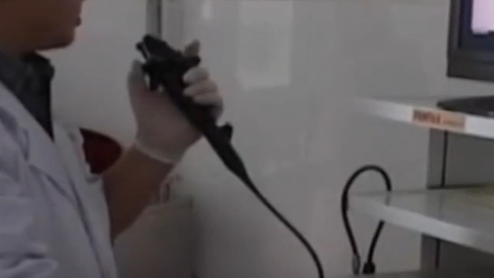 云南男子口臭手术后现在怎么样了,云南男子口臭查出了大毛病