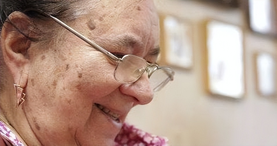 红霉素祛老年斑最有效的偏方,祛老年斑小妙招红霉素软膏