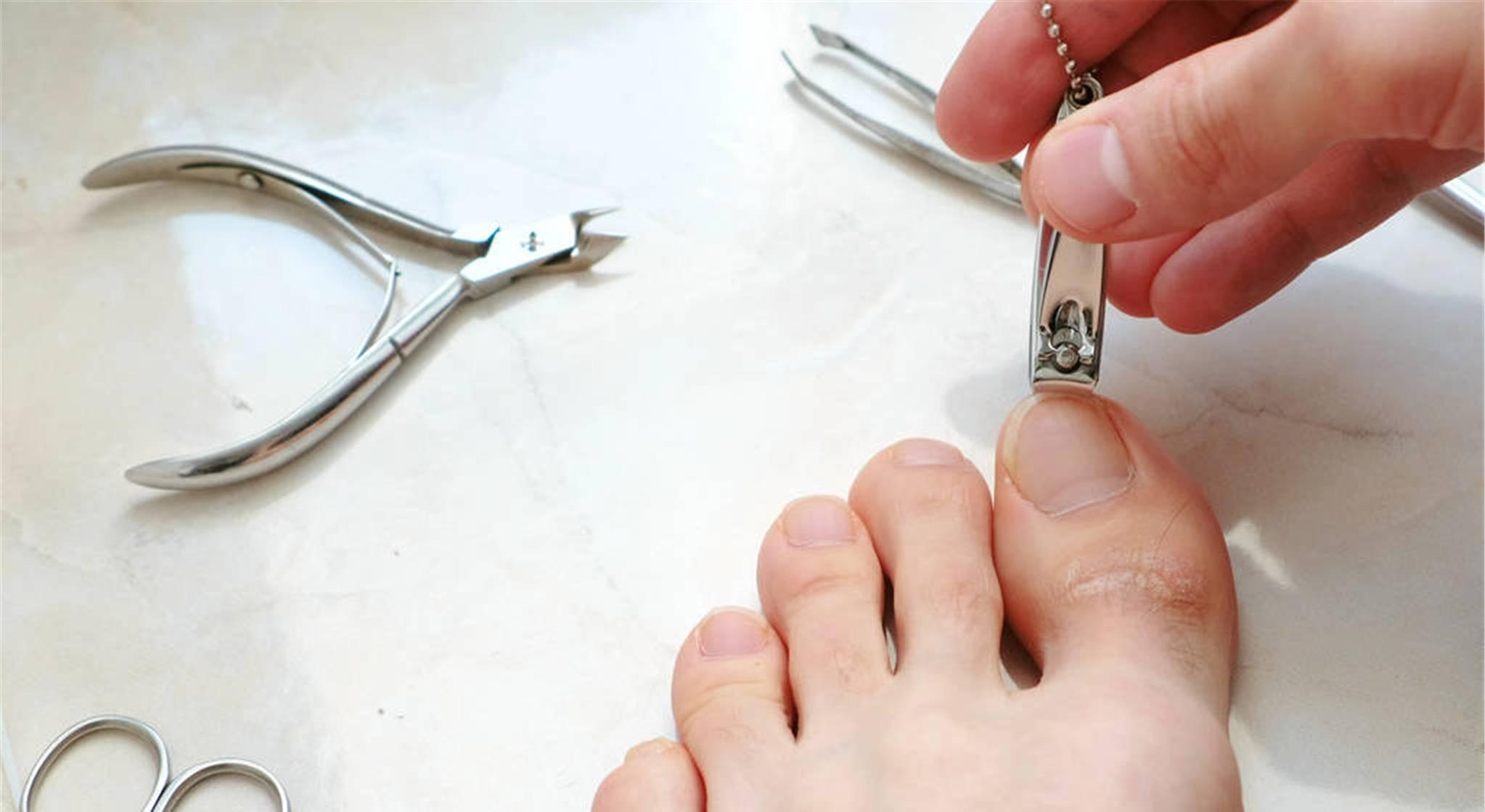 得了甲沟炎一定要拔指甲就能好吗,甲沟炎指甲陷肉里拔不出来怎么办