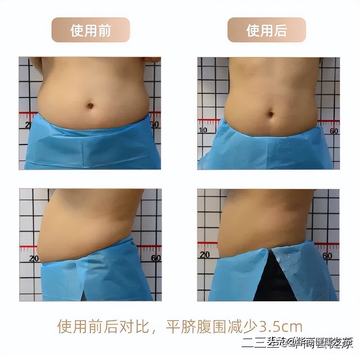 不节食打造易瘦体质,不节食也能保持身材的10个秘诀