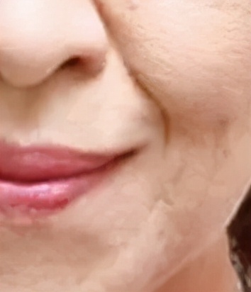 奖门人提醒：别叫“纹”题成问题，皮肤科医生教您抵抗岁月痕迹