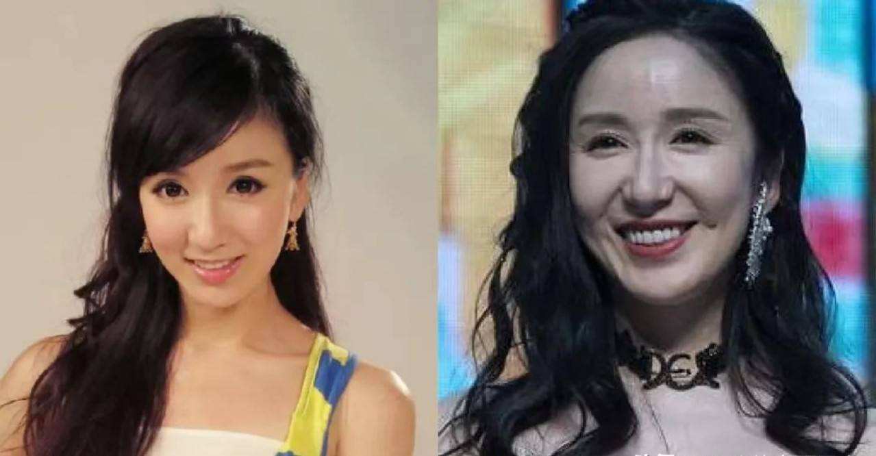 最失败硅胶脸的女星,硅胶脸女明星排行