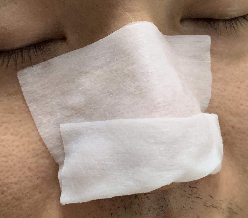 毛孔堵塞毛孔发黑怎样清理,毛孔长螨虫堵塞毛孔怎么办