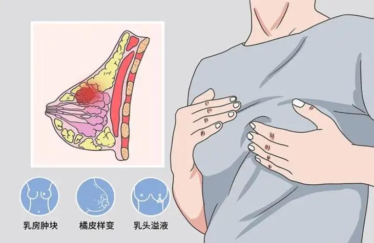 没结婚的女性能不能做两癌筛查,免费的女性两癌筛查有必要去做吗