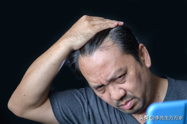 年轻人还在为秃头掉发而烦恼吗,18岁秃头越来越严重是什么原因