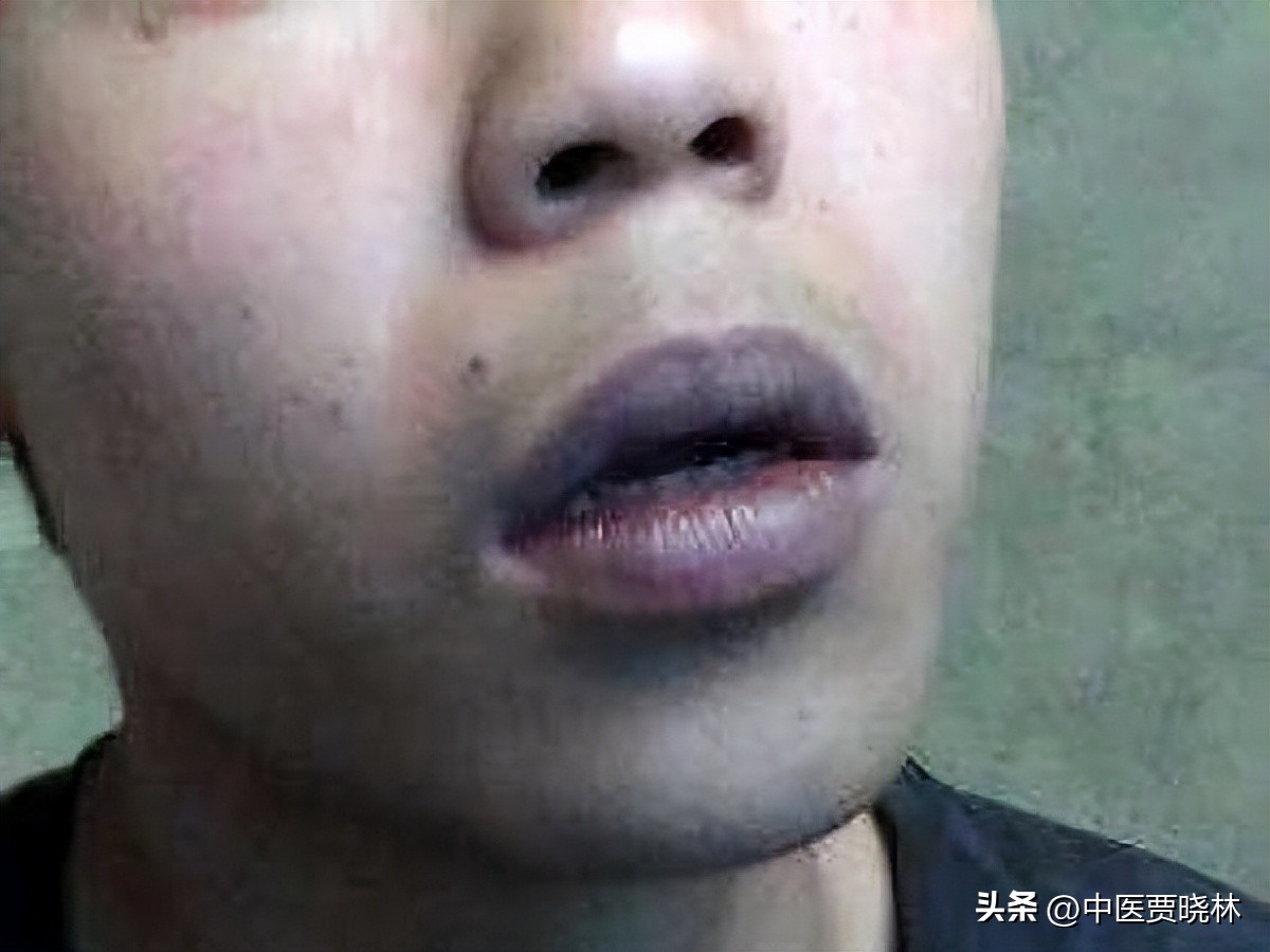 嘴唇的颜色与脾胃的关系,脾虚嘴唇颜色对照表