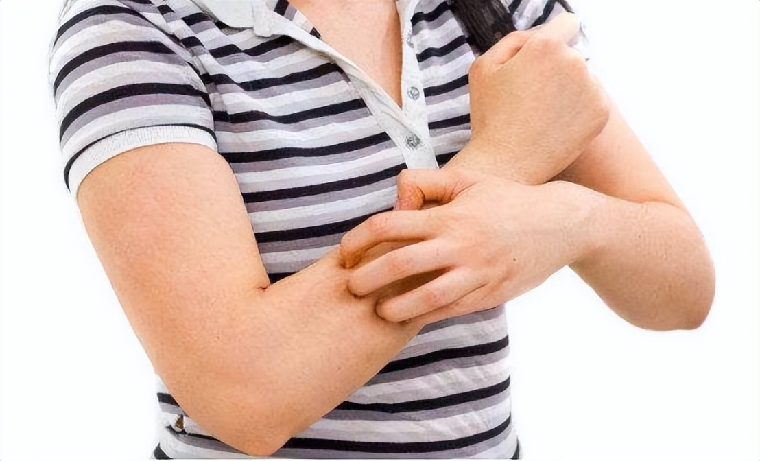 麻疹和荨麻疹有什么区别能治好吗,得了荨麻疹最正确的治疗方法