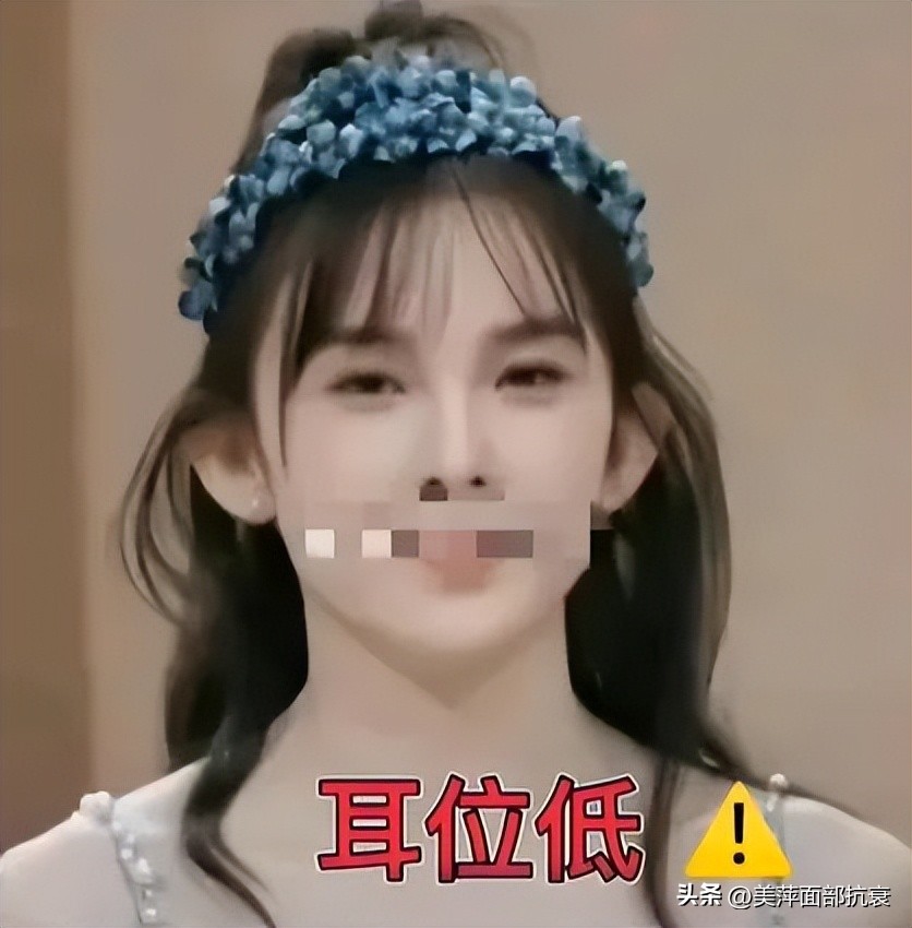 耳朵怎样才能变得更好看,如何改善耳朵好看