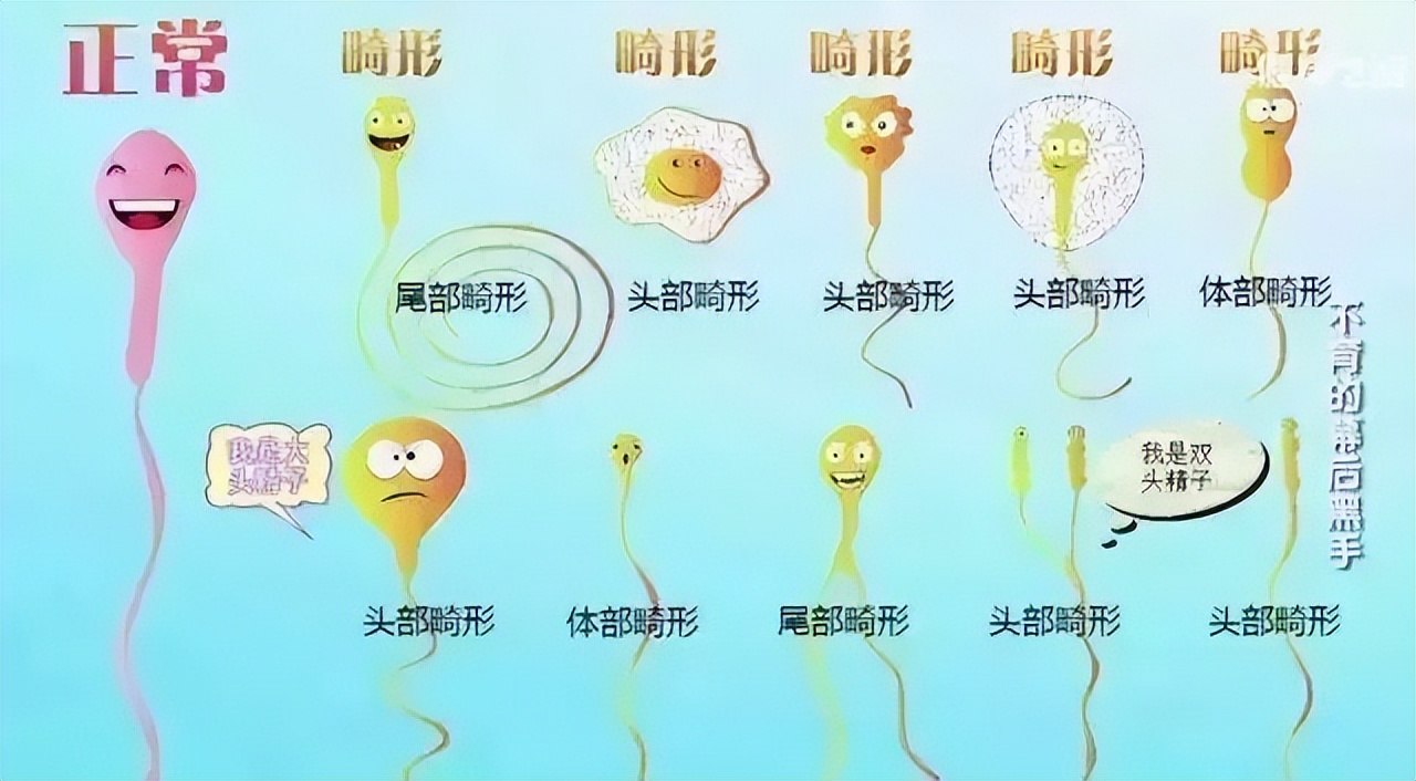 精子畸形率高也能怀孕吗,精子畸形率高不治疗能怀孕吗