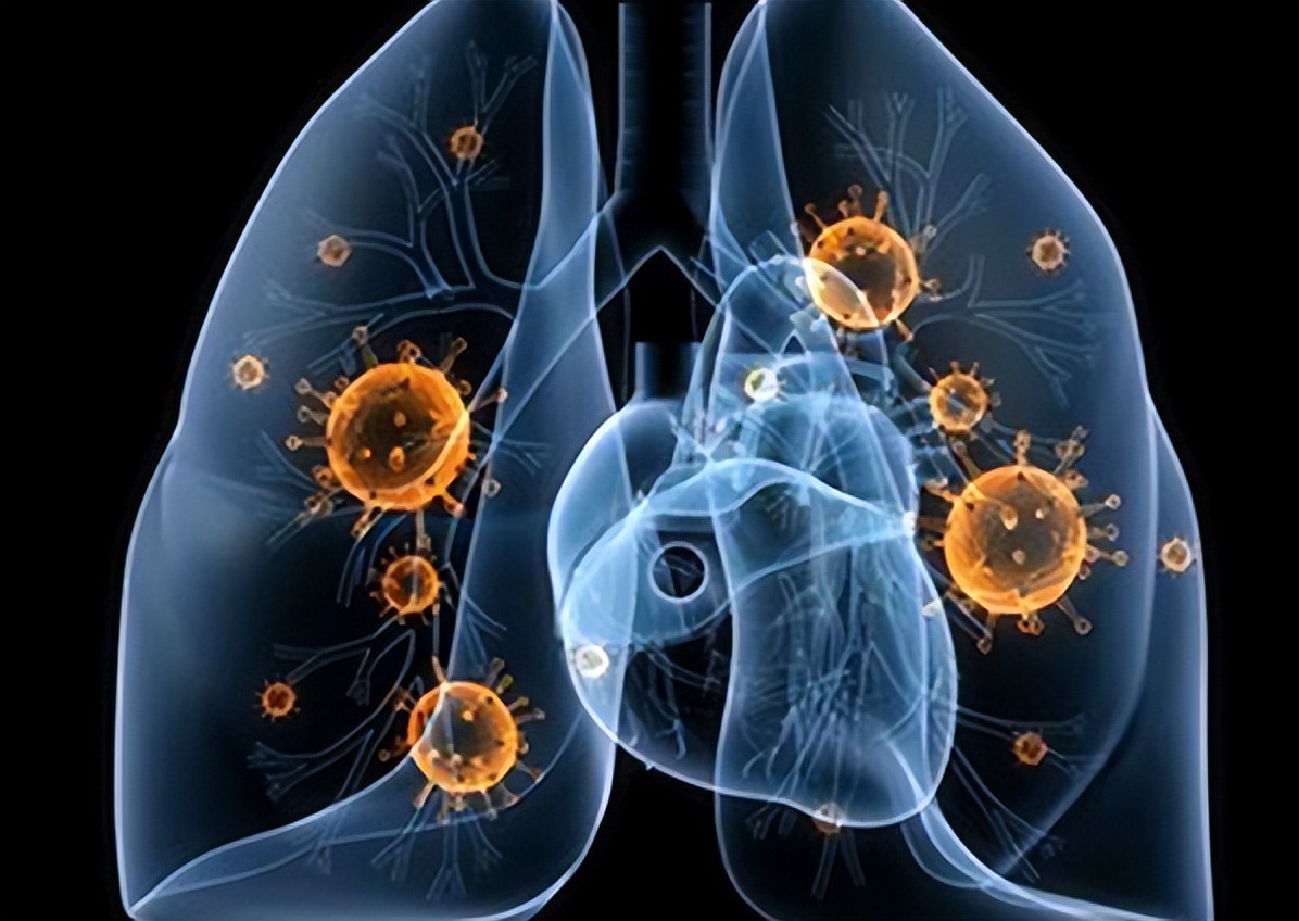 阿莫西林是好药但别乱吃,阿莫西林别乱吃只对这四种病有效