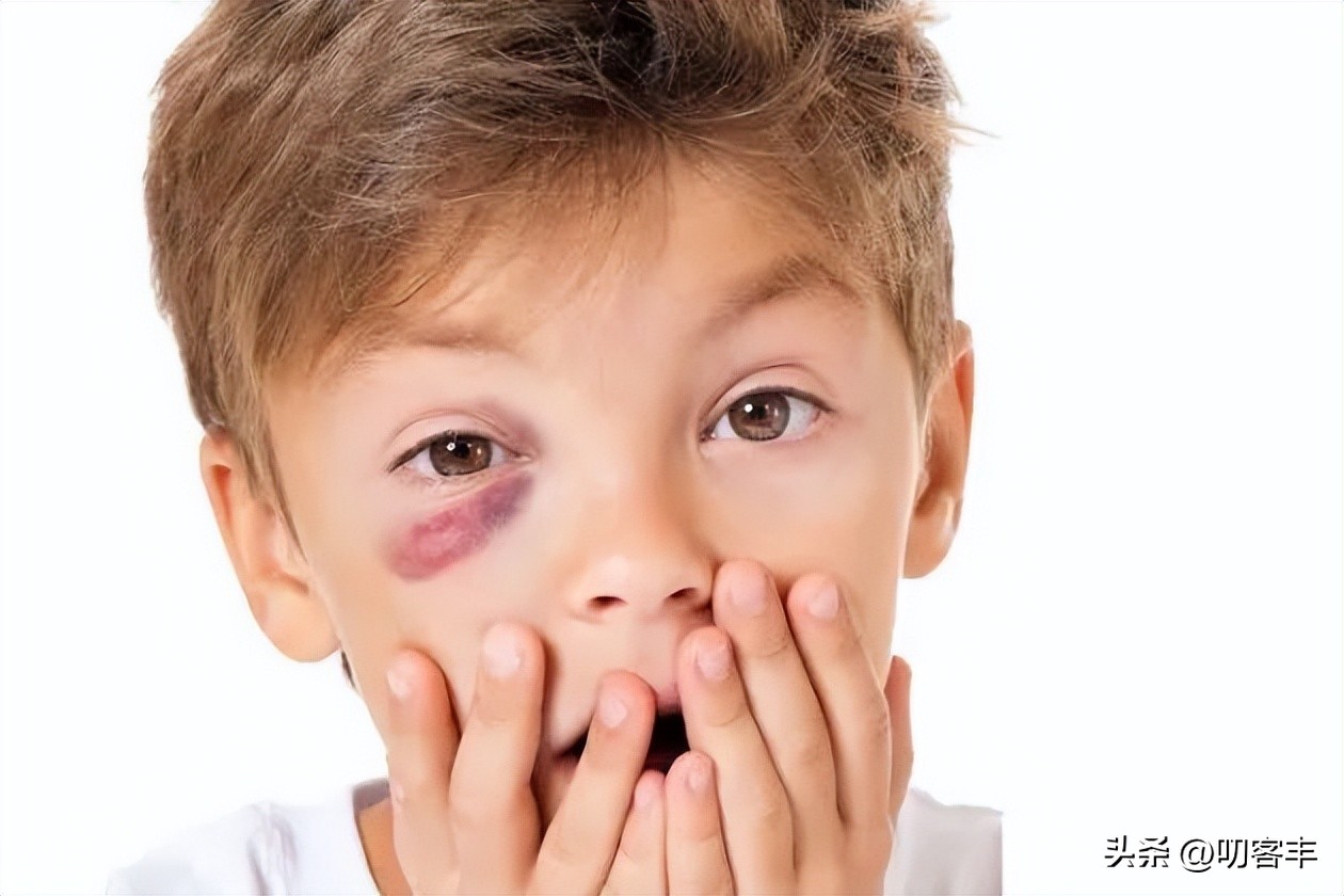 小孩眼睛受伤用什么药,孩子眼睛受伤了怎么办