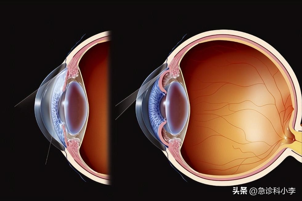 甲钴胺可以修复脑部神经受损吗,大脑中枢神经受损吃甲钴胺可以吗