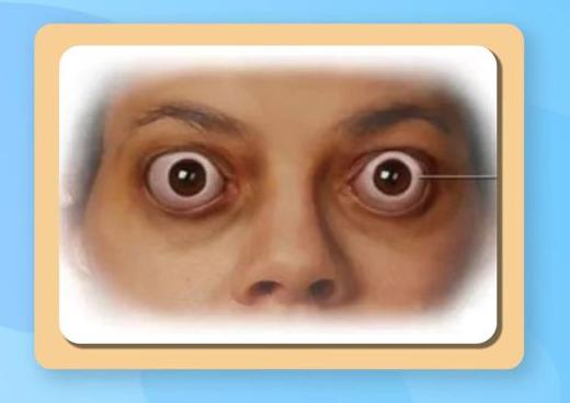 通过查眼睛能判断糖尿病吗,糖尿病眼科疾病的症状