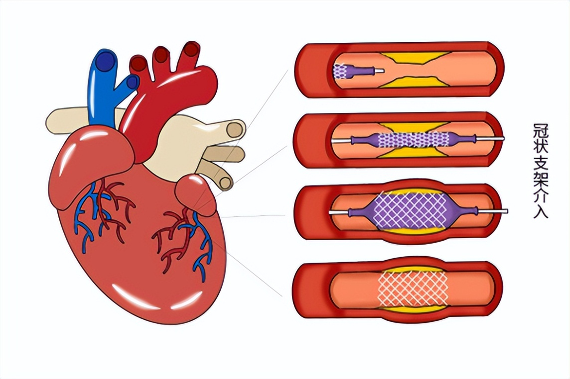 北京协和医院外科健康科普视频,协和医院健康科普