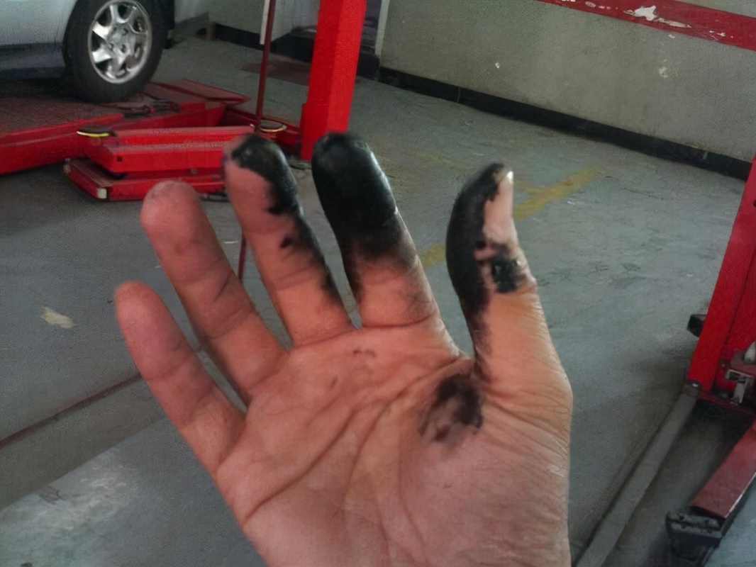 真实故事：东北一女子喝柴油“成瘾”，10年喝下数吨安然无恙