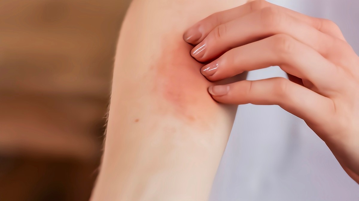 女子身上长虫医生拿镊子治疗,医生从女子腹痛取出长虫