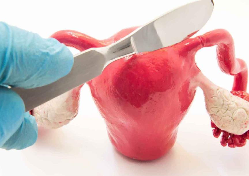 宫颈切除后还得妇科病吗,宫颈切除手术后还会转阳吗