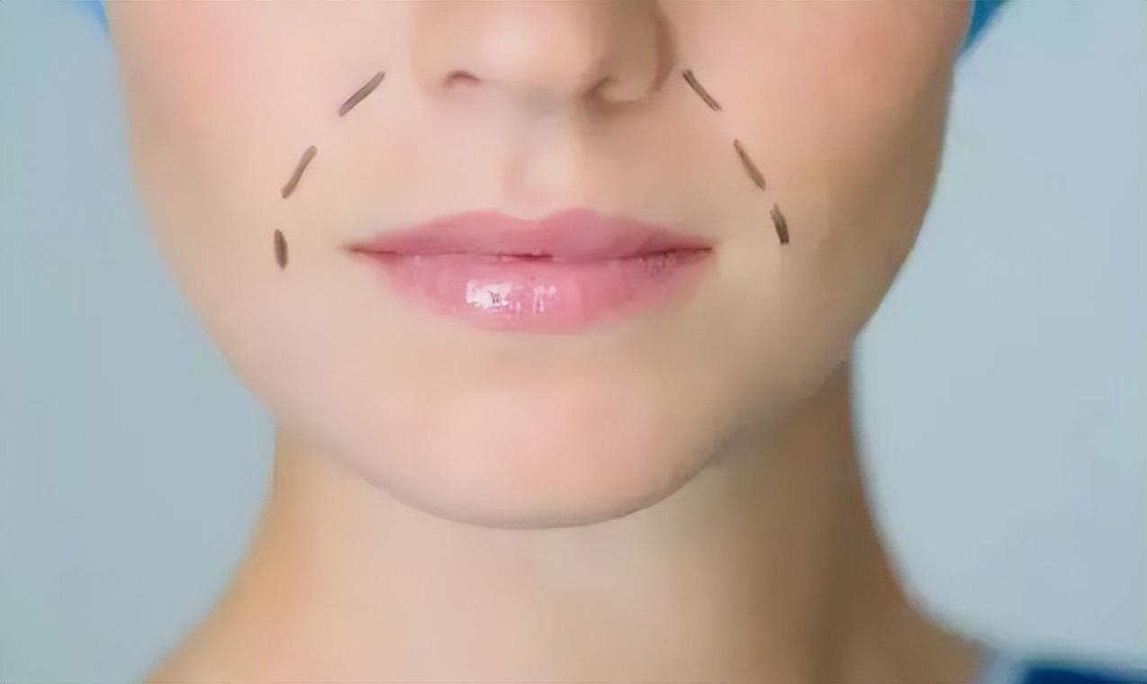 脸部皱纹分很多种，第一显老的是它？来看看如何“对症下药”