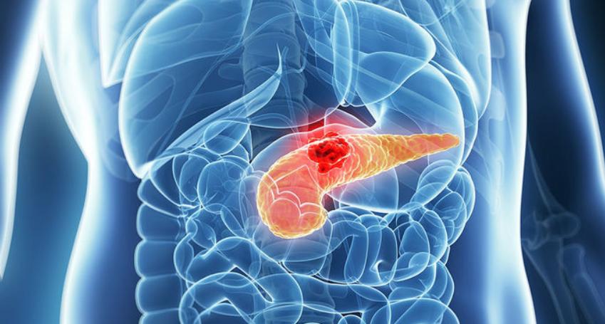 小伙讲述经常拉肚子肠癌,老是拉肚子查出来是癌